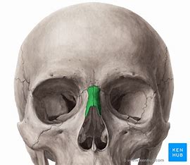 <p>What facial bone is this?</p>