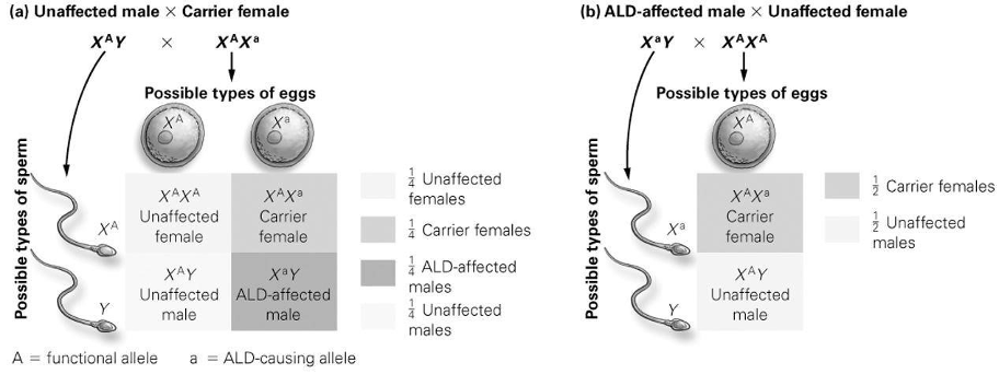 <p><span style="font-family: &quot;Times New Roman&quot;; font-size: 16px;">According to the Punnett square diagram, what percentage of possible male offspring would be unaffected by adrenoleukodystrophy (ALD) if the father is unaffected by ALD and the mother is a carrier of ALD?</span></p><p><span style="font-family: &quot;Times New Roman&quot;; font-size: 16px;">A)</span><span style="font-family: &quot;Times New Roman&quot;; font-size: 9.33px;">&nbsp; </span><span style="font-family: &quot;Times New Roman&quot;; font-size: 16px;">0%</span></p><p><span style="font-family: &quot;Times New Roman&quot;; font-size: 16px;">B)</span><span style="font-family: &quot;Times New Roman&quot;; font-size: 9.33px;">&nbsp; </span><span style="font-family: &quot;Times New Roman&quot;; font-size: 16px;">25%</span></p><p><span style="font-family: &quot;Times New Roman&quot;; font-size: 16px;">C)</span><span style="font-family: &quot;Times New Roman&quot;; font-size: 9.33px;">&nbsp; </span><span style="font-family: &quot;Times New Roman&quot;; font-size: 16px;">50%</span></p><p><span style="font-family: &quot;Times New Roman&quot;; font-size: 16px;">D)</span><span style="font-family: &quot;Times New Roman&quot;; font-size: 9.33px;">&nbsp; </span><span style="font-family: &quot;Times New Roman&quot;; font-size: 16px;">75%</span></p>