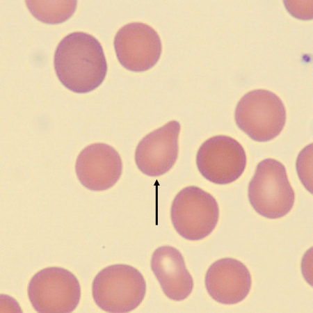 <p>What is the shape of this erythrocyte?</p>