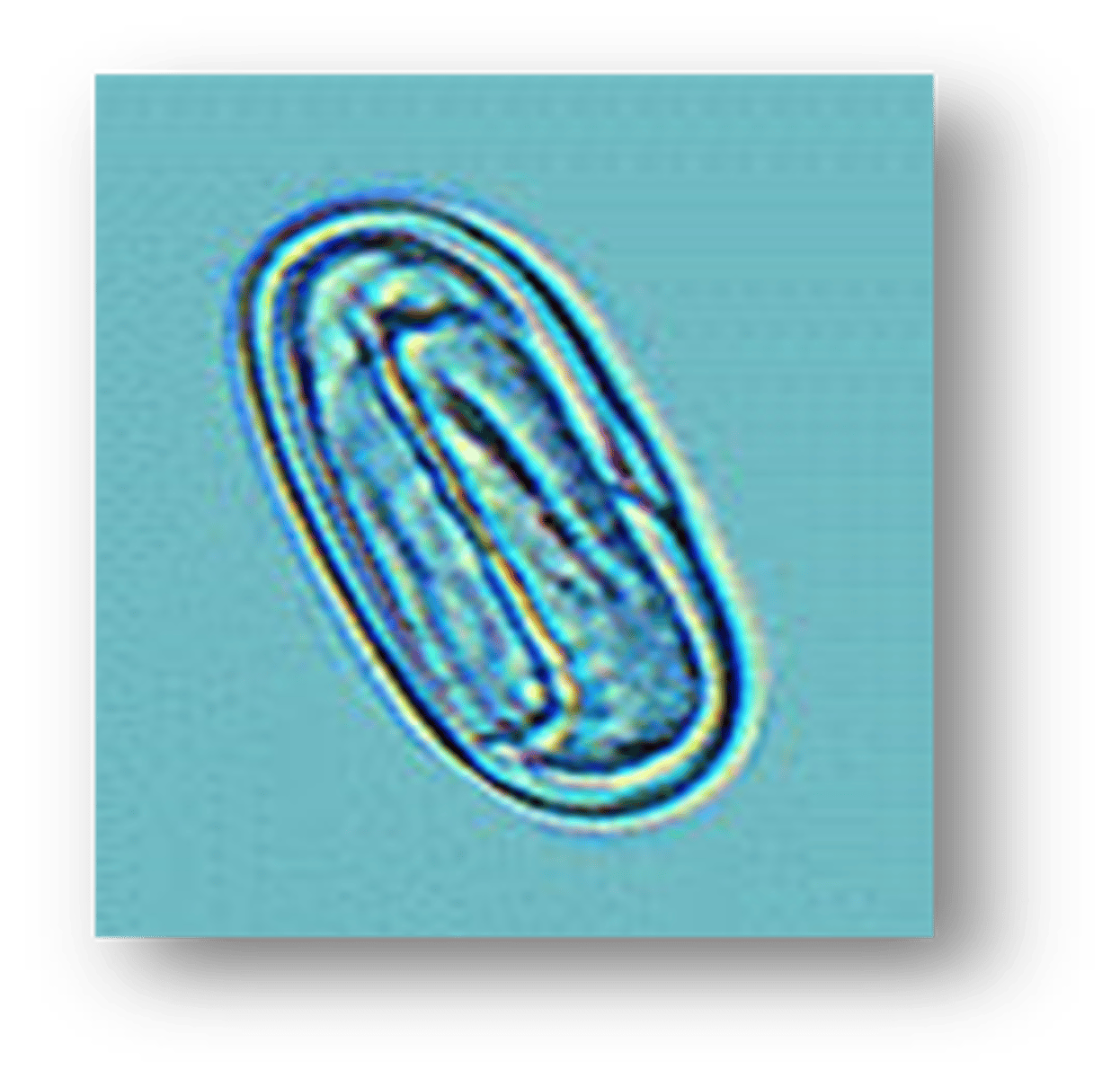 <p>Spirocerca lupi</p>