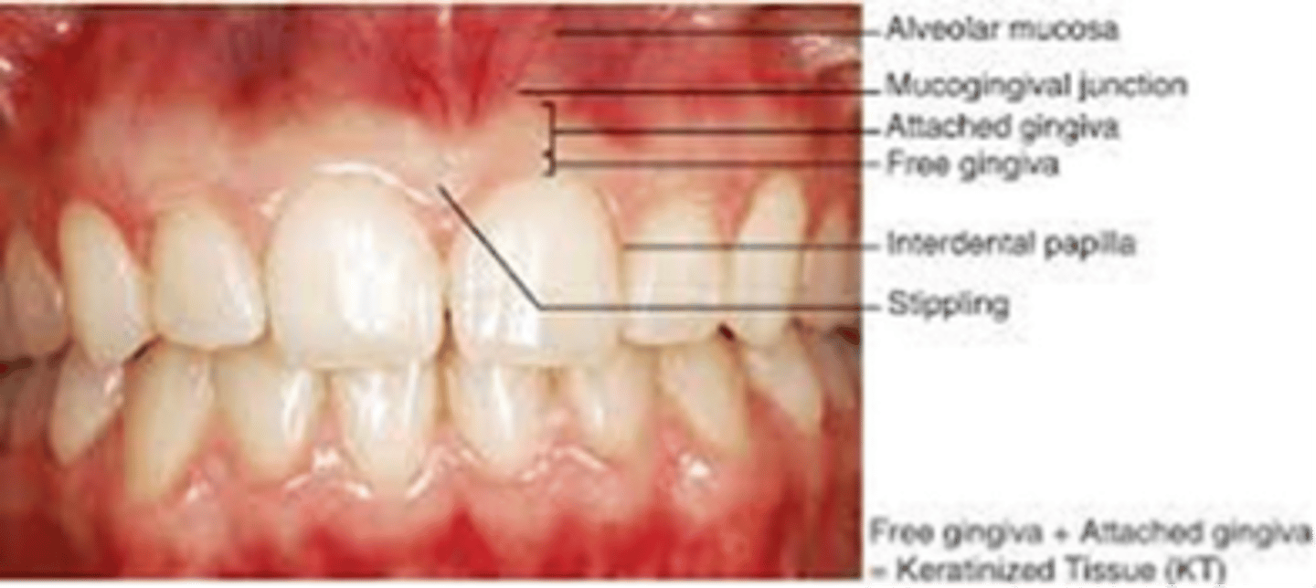 <p>describe mucosa and where it is located</p>