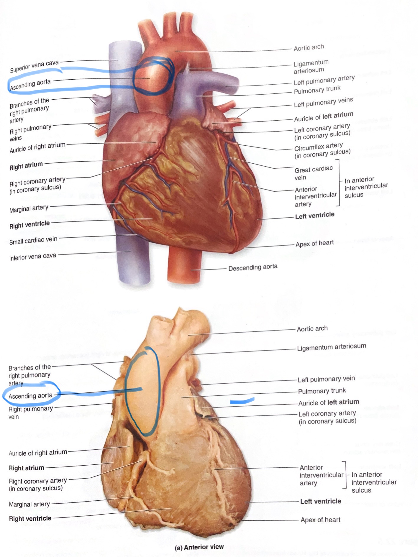 <p>First portion of the aorta leaving the left ventricle.</p>
