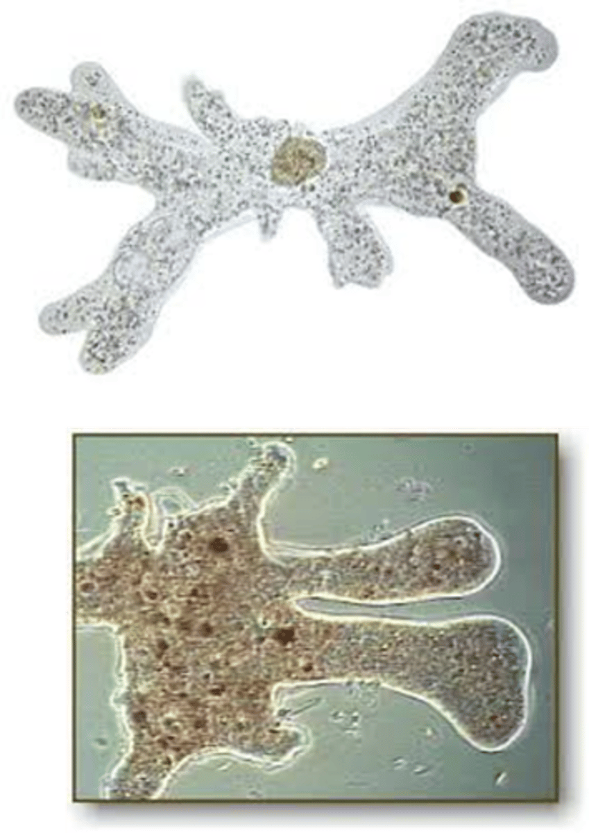 <p>amorphous and has pseudopodia</p>