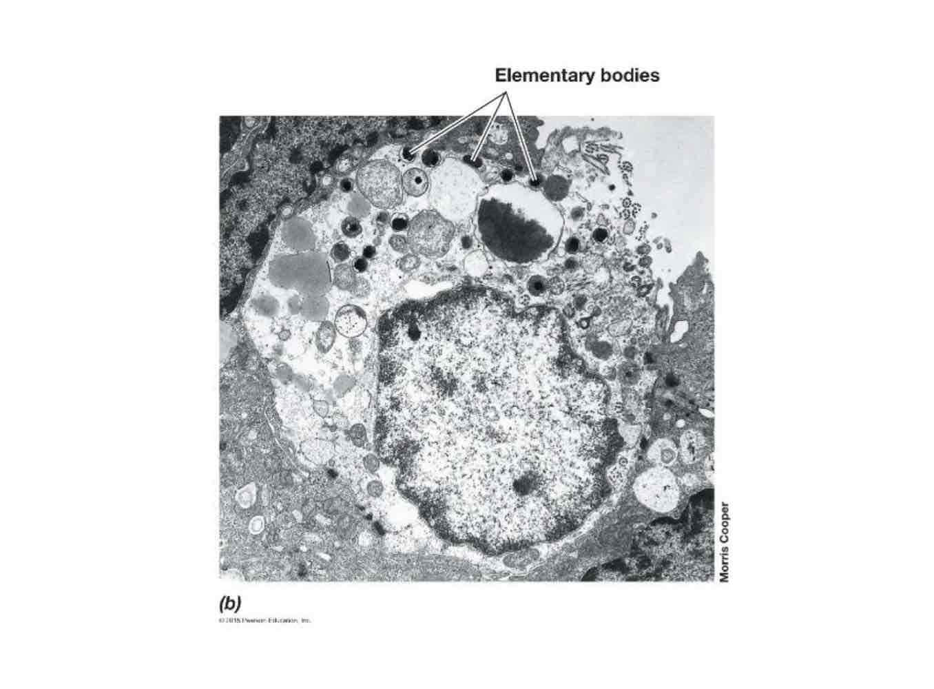 <p>Elementary: Resists drying for some period of time, being able to go from host to host.</p><p>Reticulate: Multiply inside an existing host without infection.</p>