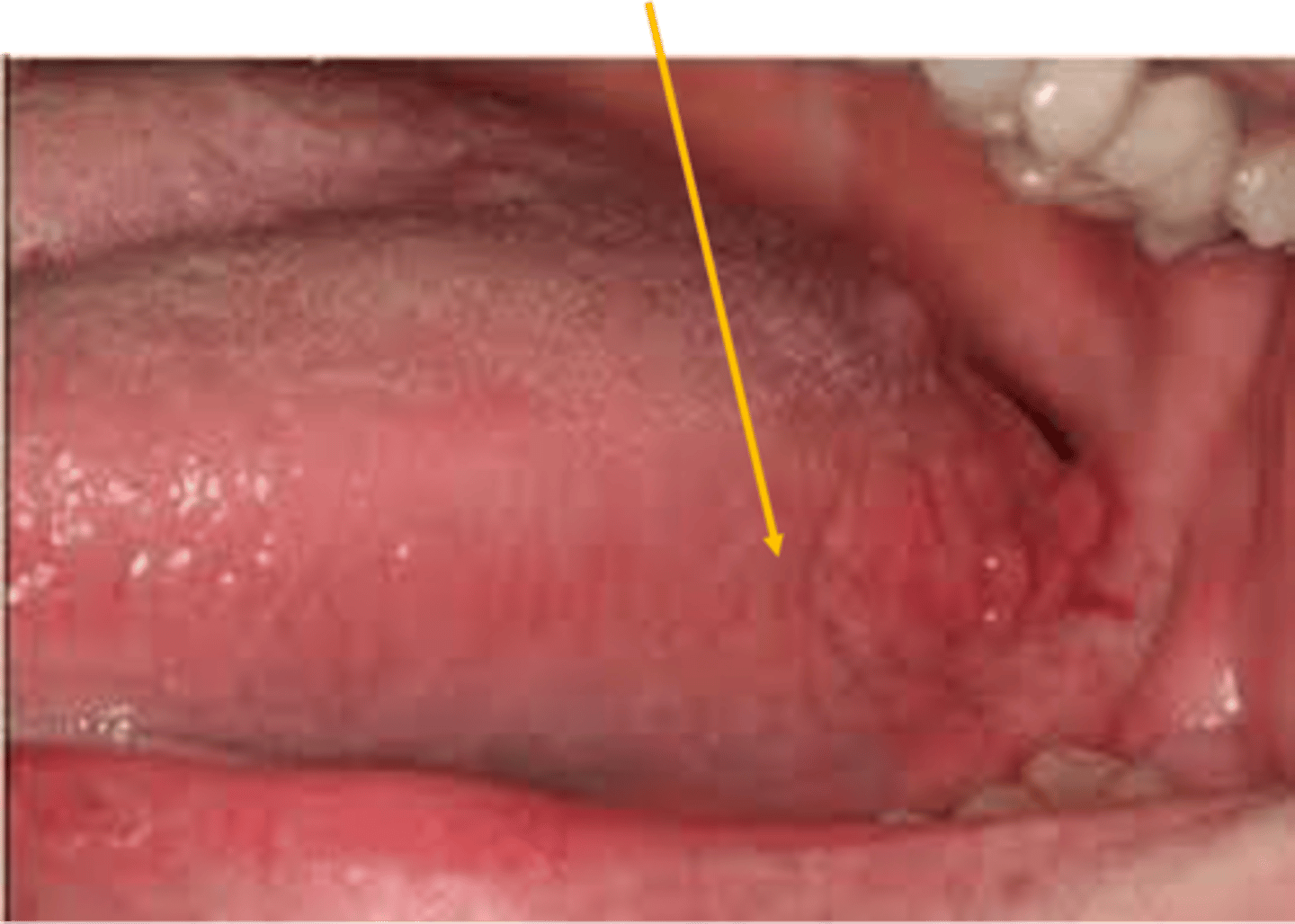 <p>What type of papilla is this?</p>