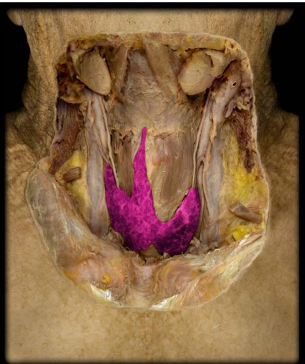 <p>what gland is this</p>