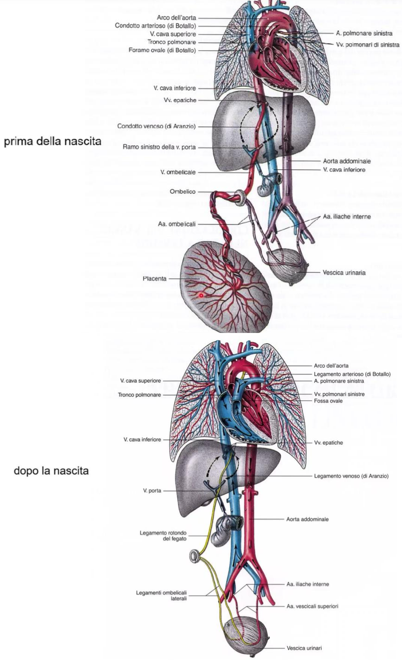 <p>Nel feto, fegato e polmoni non sono ben sviluppati, quindi è la Placenta la fonte di sangue ossigenato e nutrienti</p><p>Per questo motivo, questi due organi vengono bypassati attraverso:</p><ul><li><p>Dotto Venoso → connette il Ramo Sinistro della Vena Porta alla Vena Cava Inferiore, bypassando i sinusoidi epatici</p></li><li><p>Foro Ovale → nel setto interatriale, consente il passaggio da atrio dx a sx, bypassando la circolazione polmonare</p></li><li><p>Dotto Arterioso → connette tronco polmonare ad arco aortico, anch’esso bypassa la circolazione polmonare</p></li></ul><p>Percorso del sangue ossigenato:</p><ul><li><p>Placenta → vena ombelicale (che porta sangue ossigenato) → fegato, che viene per lo più bypassato attraverso il dotto venoso d’arazio, dal ramo sinistro della vena porta → vena cava inferiore → atrio destro</p></li><li><p>Da qui il sangue passa all’atrio sinistro attraverso il Foro Ovale → ventricolo sinistro → aorta</p></li><li><p>Dai rami dell’arco, viene garantito ossigeno a testa, collo e arti superiori</p></li></ul><p>Percorso del sangue deossigenato:</p><ul><li><p>Vena cava superiore porta sangue deossigenato (da testa, collo, arti superiori) → atrio destro → ventricolo destro → tronco polmonare → dotto arterioso (si bypassa la circolazione polmonare) → arco aortico</p></li><li><p>A livello dell’aorta discendente, il sangue ossigenato si mescola con quello deossigenato </p></li><li><p>Da qui il sangue raggiunge le arterie iliache comuni, poi interne, ciascuna delle quali origina un’arteria ombelicale che riportano sangue non ossigenato alla placenta</p></li></ul><p>Alla nascita:</p><ul><li><p>Con l’inizio della respirazione polmonare e delle funzione epatica</p></li><li><p>Il dotto venoso di oblitera e diventa legamento venoso</p></li><li><p>Il foro ovale si chiude e diventa fossa ovale</p></li><li><p>Il dotto arterioso di botallo di oblitera e diventa legamento arterioso</p></li><li><p>Il tratto distale delle arterie ombelicali si oblitera e diventano legamenti ombelicali laterali</p></li><li><p>Il tratto prossimale delle arterie ombelicali diventano rami dell’arteria iliaca interna per visceri pelvici</p></li></ul><p></p>