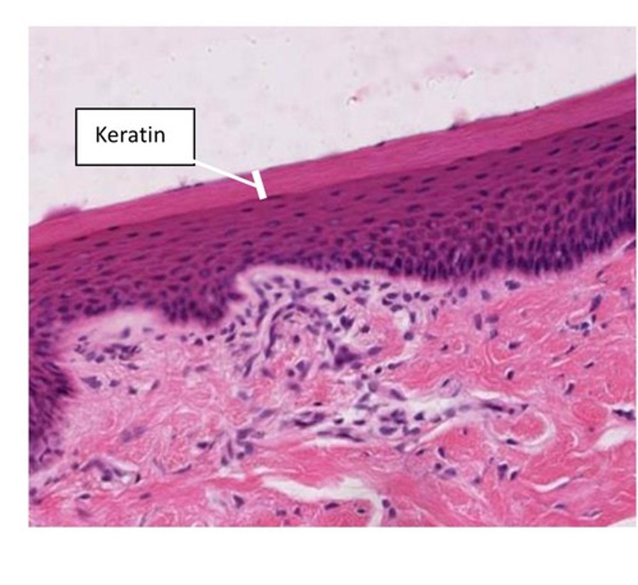 <p>surface layers devoid of nuclei, called keratin. Amount of keratin can vary. Typical locations: integument (dry surfaces mostly), hard palate, areas of high "wear and tare".</p>