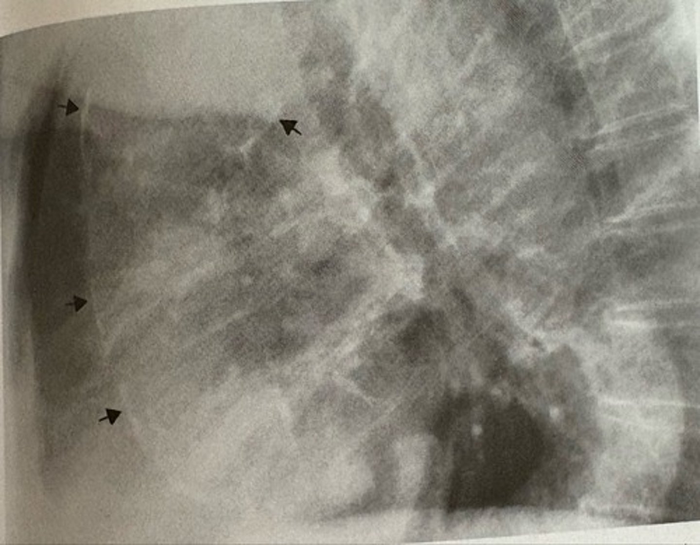 <p>what pathology is present?</p>