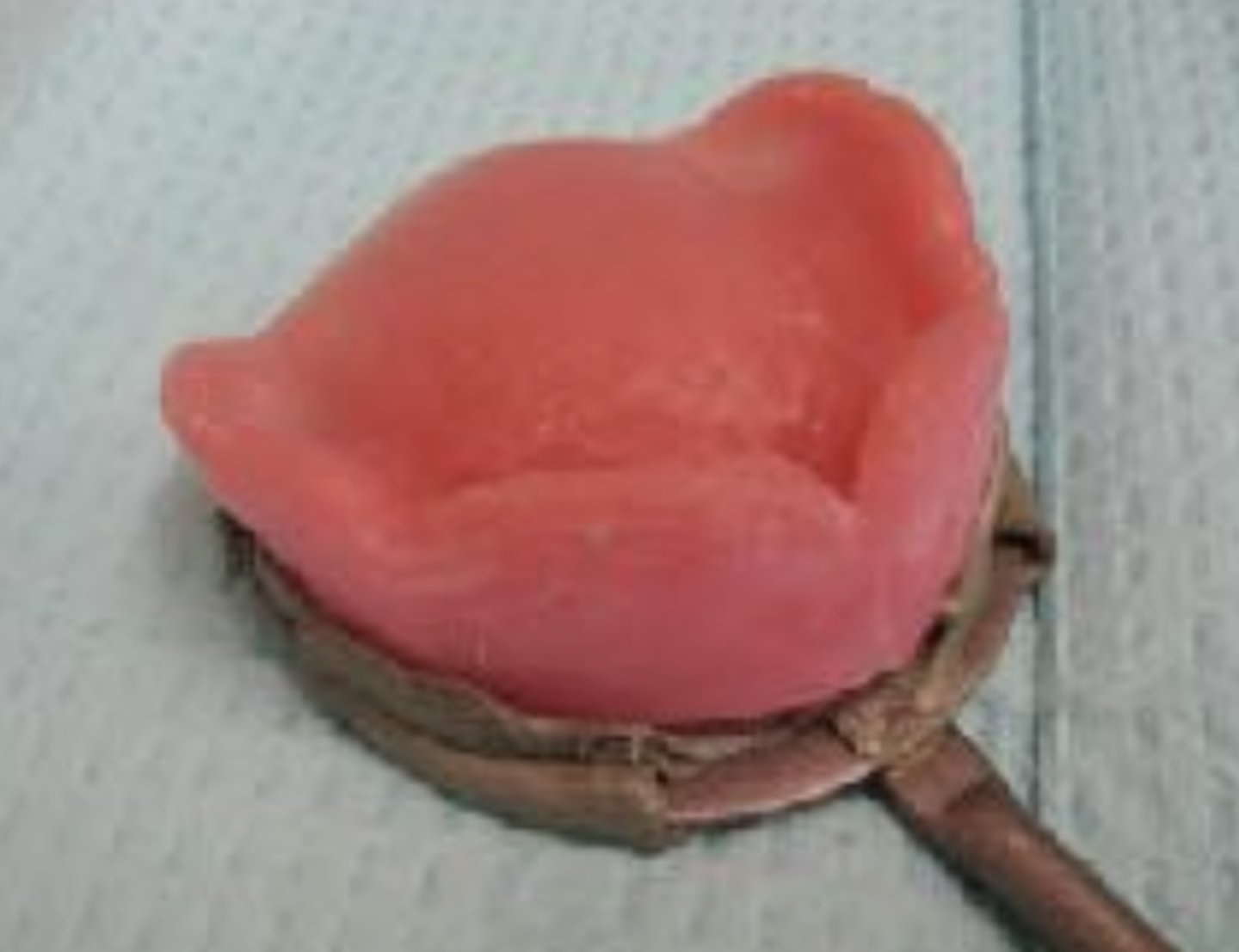 <p>When positioning the maxillary rim on the bite fork, what is MOST important?</p>