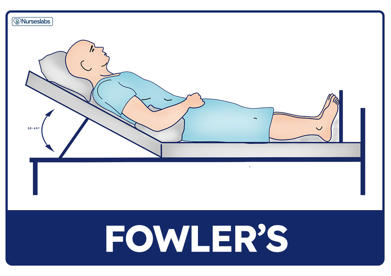 <p>The patient lies on their back with their head elevated at one of the several different angles. <strong>It is best used when the patient is experiencing trouble breathing.</strong></p>