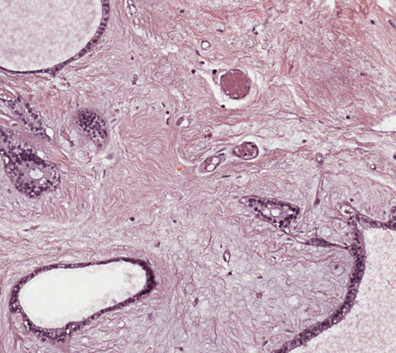 <p>Breast</p>