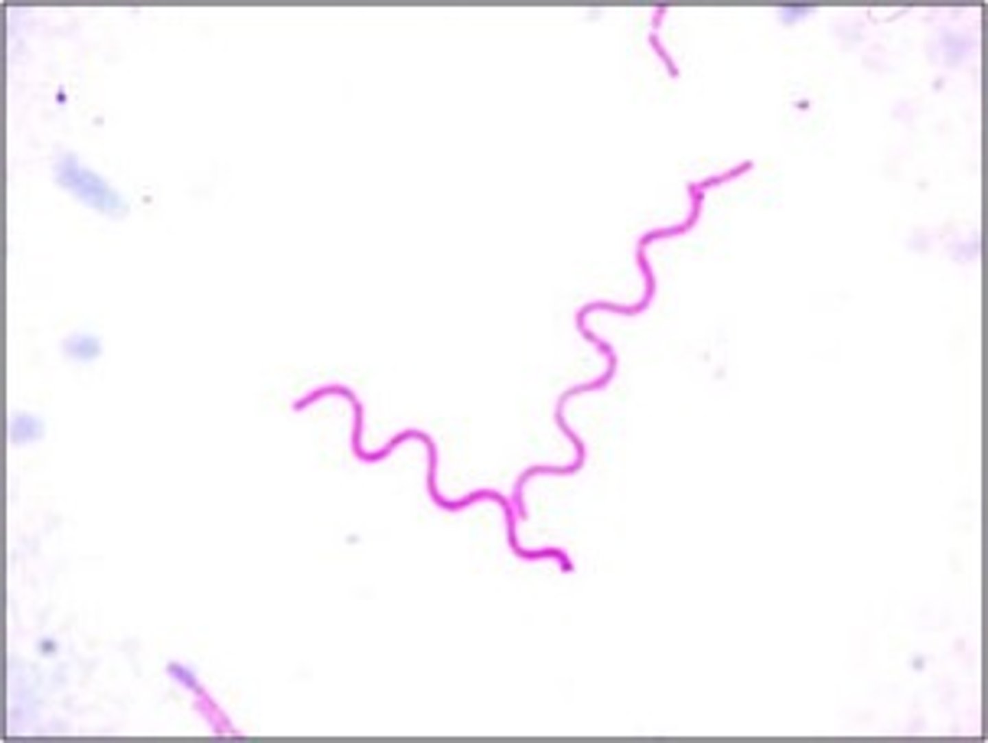 <p>This is an example of</p>