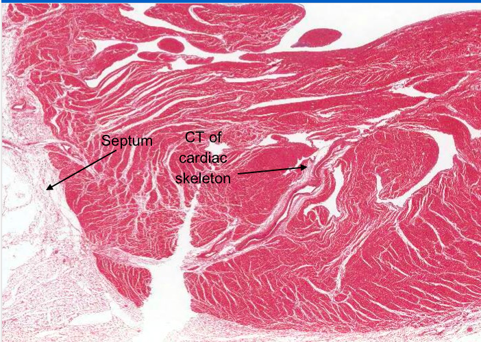 myocardium of ventricle