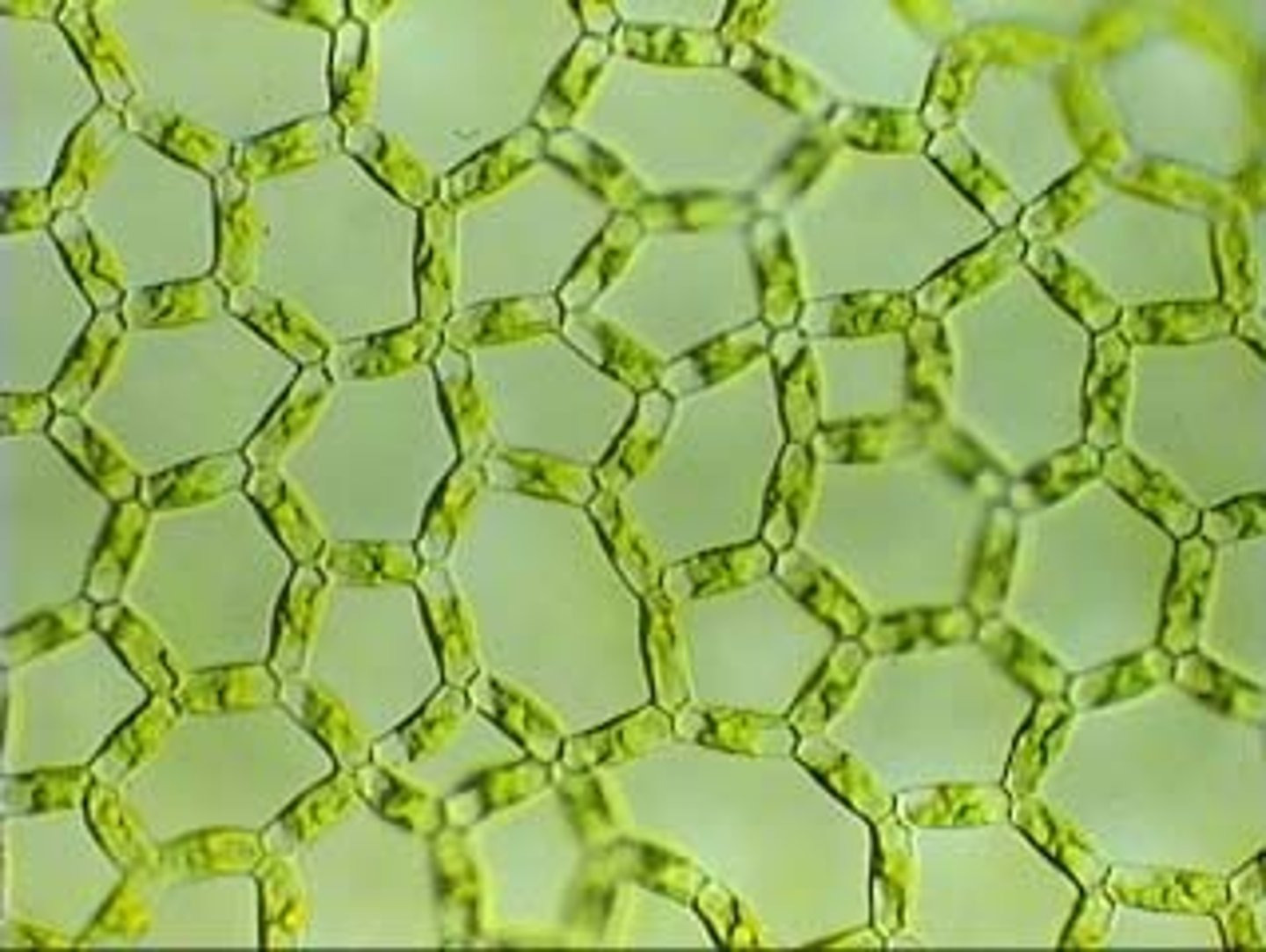 <p>(cholophyceae)</p><p>AKA water net, hollow cylinders with reticulate chloroplasts</p>