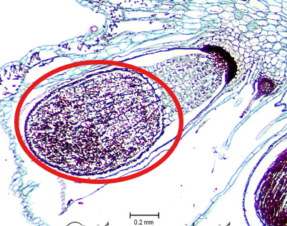 <p>Which part of the Sporphyte is this?</p>