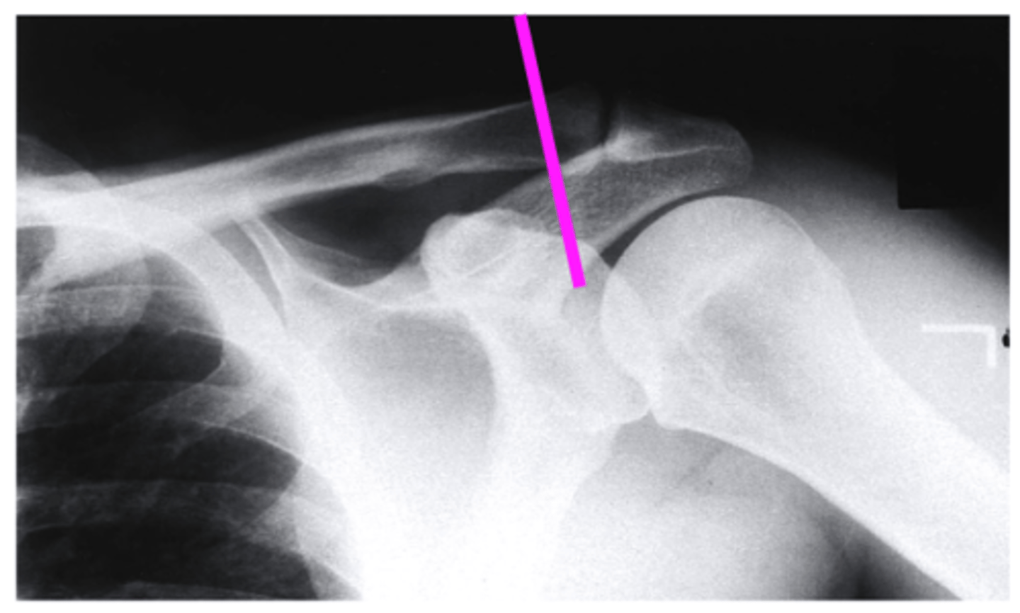 <p>what does the pink line point to?</p>