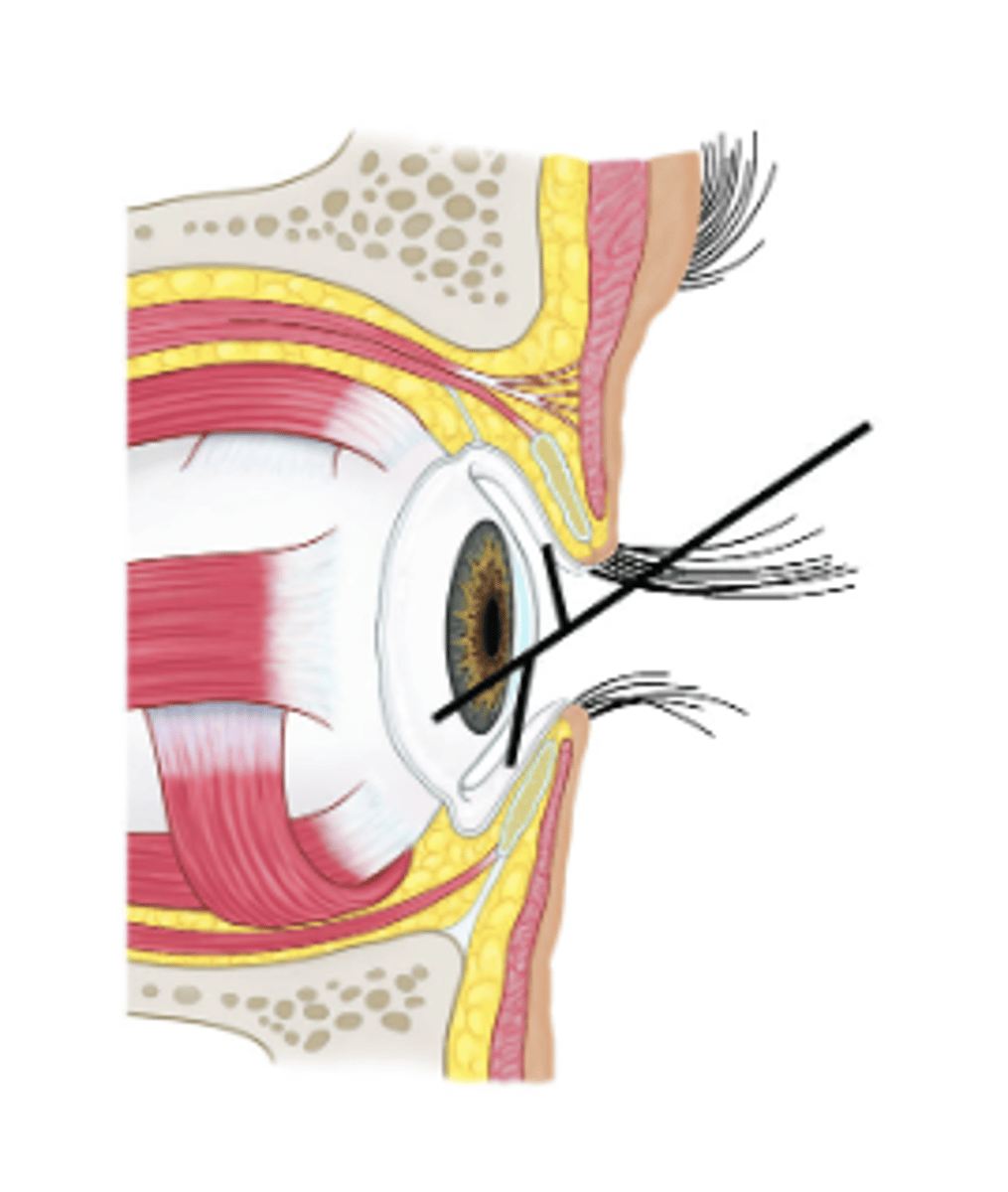 <p>Identify structure.</p>