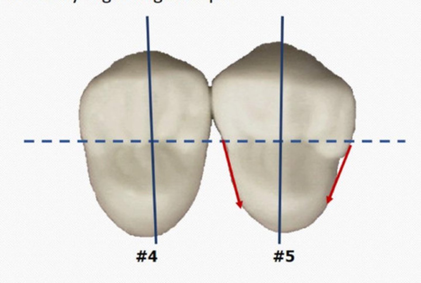 <p>The second premolar is typically more __ and less angular</p>