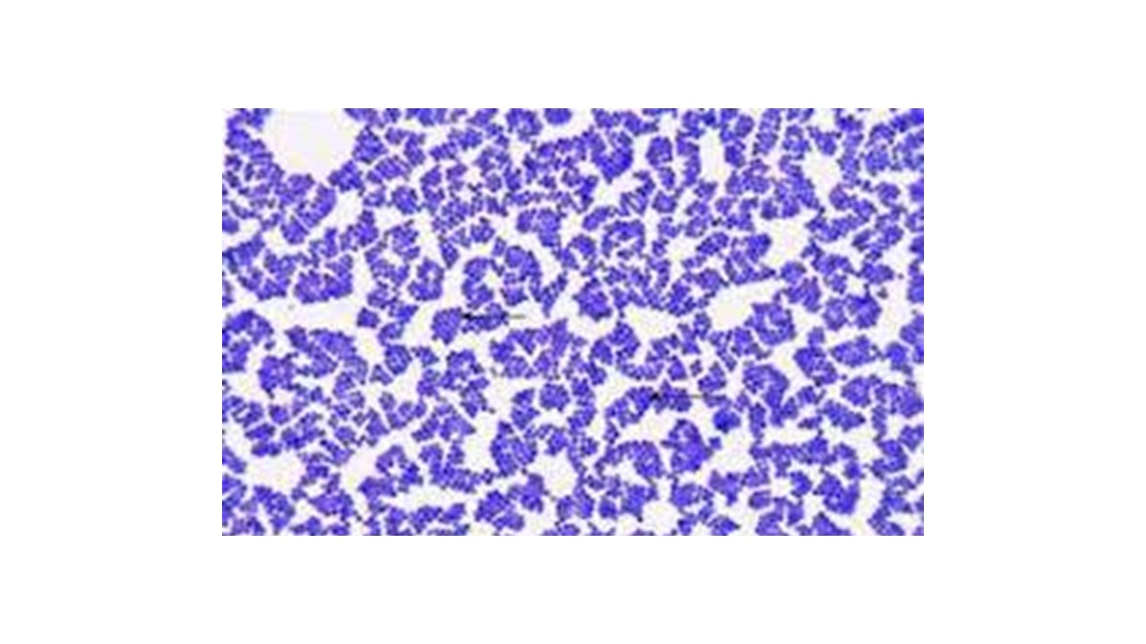 <p><span>looking at the micrograph, is Staphylococcus aureus Gram positive or Gram negative</span></p>