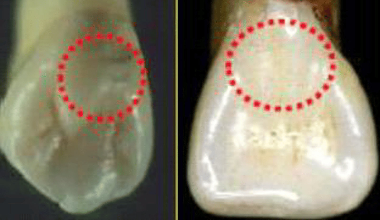 <p>what is this? (the sticky out bit on palatal surface of anterior teeth)</p>