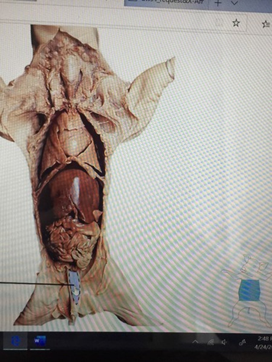 knowt flashcard image