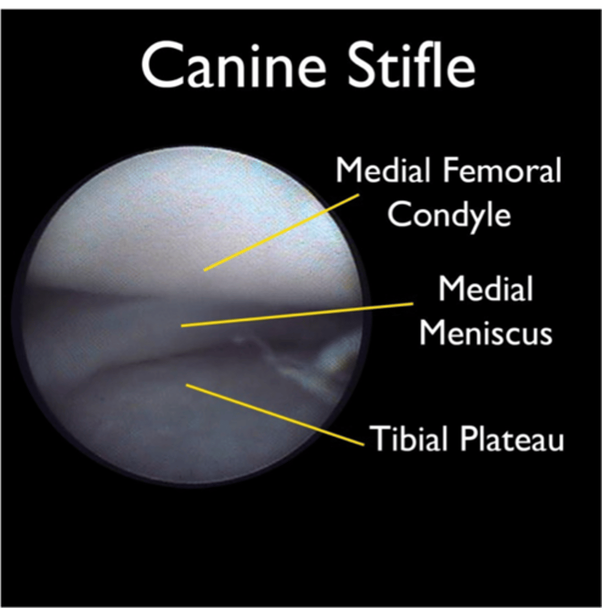 <p>what are the primary diagnostics for meniscal injury</p>
