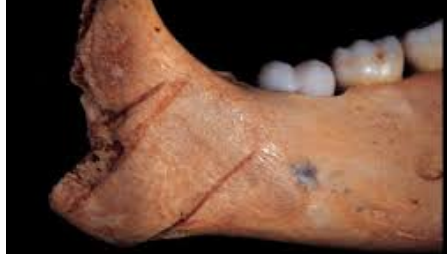 <p>narrow blades, leave corresponding narrow ‘V’-shaped trough in bone, single/double-bladed — double-bladed can leave opposite ‘V’-shaped trough in bone, tend to leave behind only microscopic striations </p>