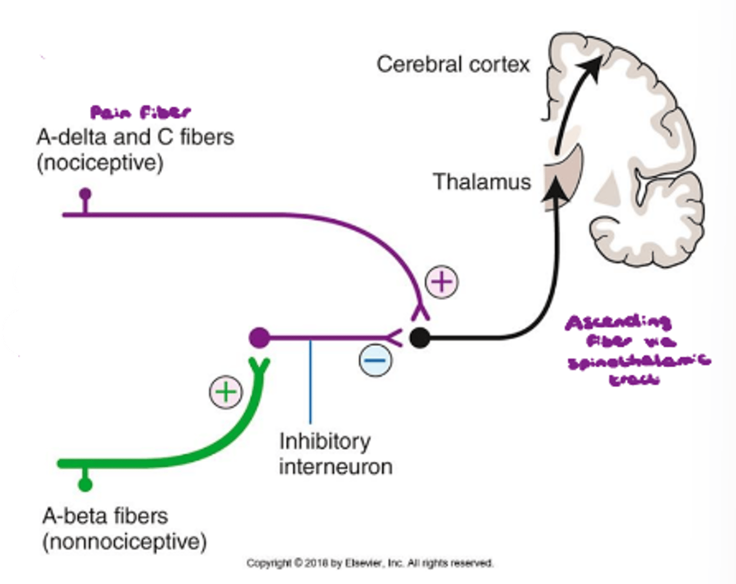 <p>Pre-synaptic inhibition of the spinal cord via the A-beta fibers being stimulated. → Sensation of pain never reaches the brain for interpretation.</p>