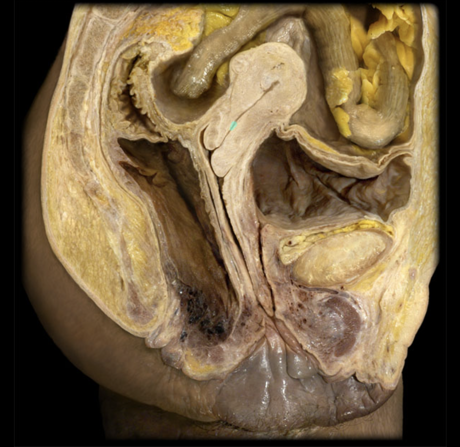 <p>What structure is shown?</p>