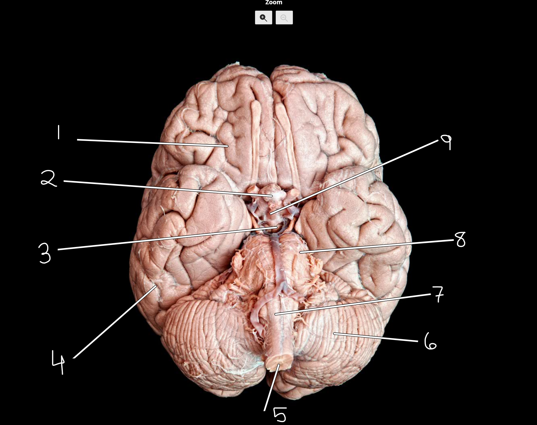 <p>Brain structures: inferior view </p>