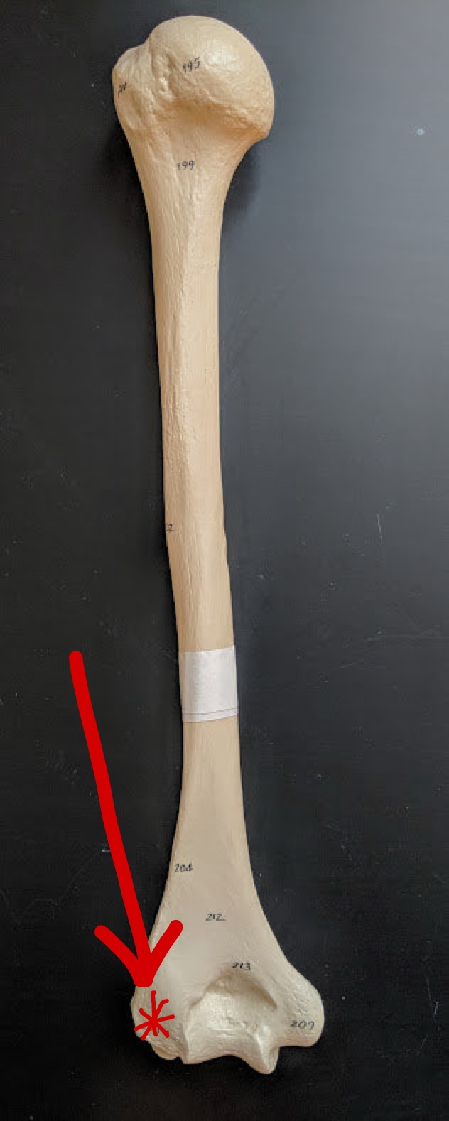 <p>Name this structure</p>