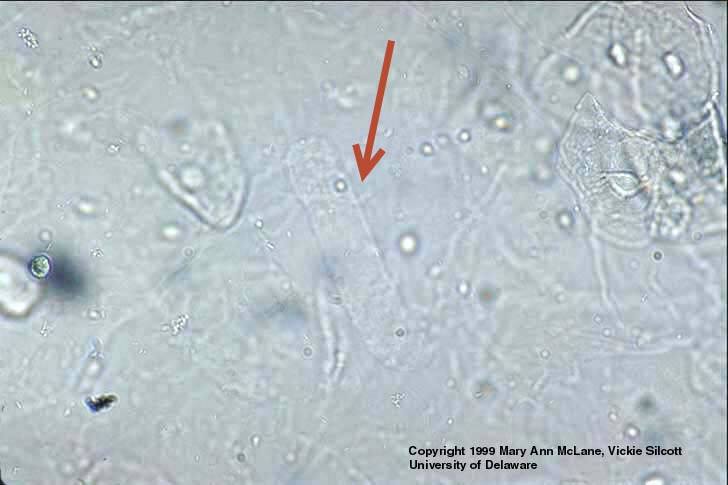 <ol><li><p>Identify pointed structure.</p></li><li><p>Normally, what disease is associated with this structure?</p></li></ol><p></p>