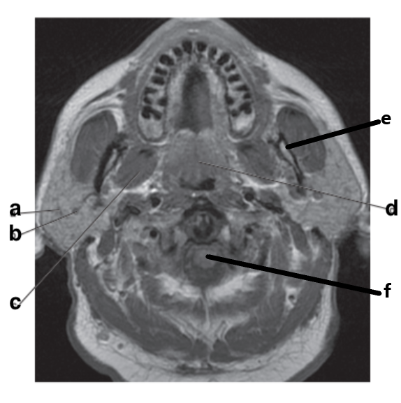 <p>What is letter e?</p>