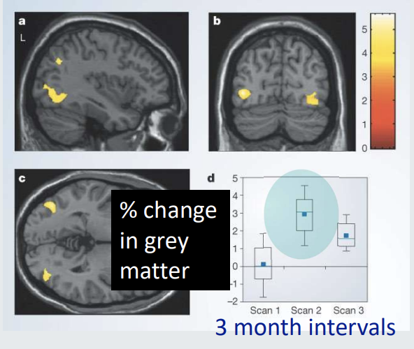 <ul><li><p><strong>Example: </strong>Learning a new skill, such as juggling</p></li><li><p><strong>Brain changes:</strong></p><ul><li><p>Structural MRI showed increased grey matter in (before and after 3 months of training):</p><ul><li><p>mid-temporal area</p></li><li><p>left posterior</p></li><li><p>intraparietal sulcus</p></li></ul></li></ul></li></ul><p></p>