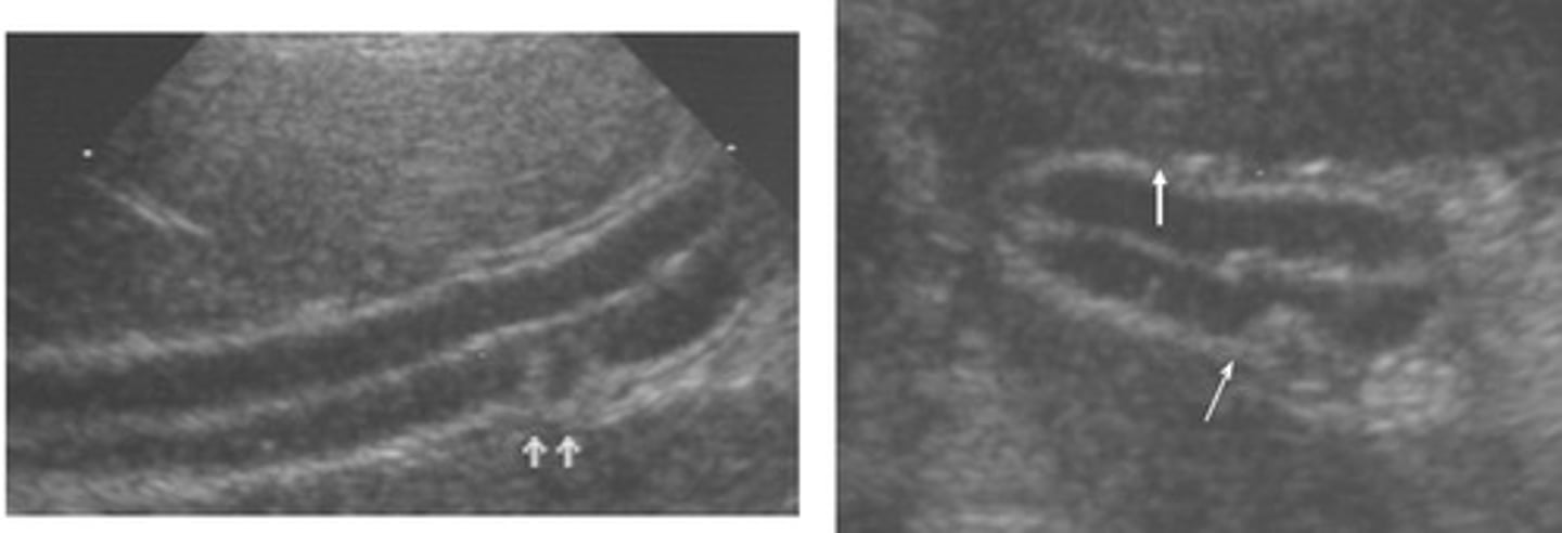 <p>which part of the intestines is this?</p>