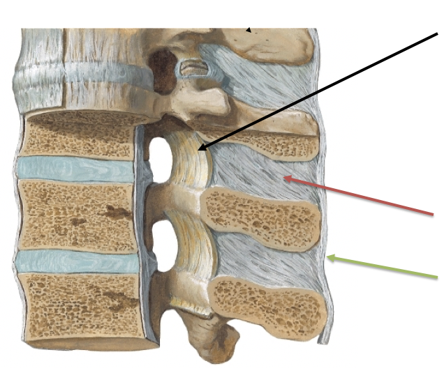 What ligament is the red arrow pointing to?

\
A. Interspinous ligament

B. Ligamentum flava

C. Supraspinous ligament 