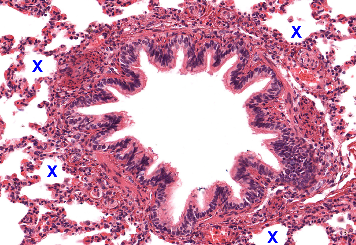 <p>Tissue type in alveoli </p>