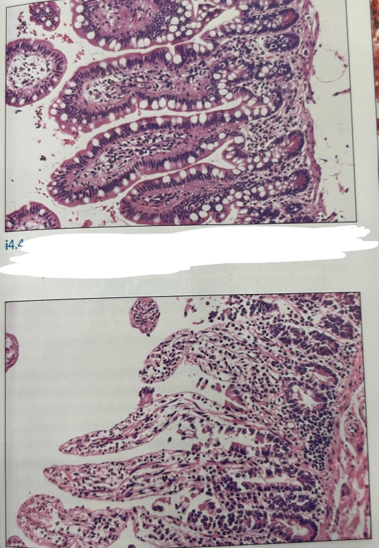 <p>What’s the difference between these two samples?</p>