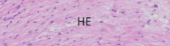 <p>Eosinofilt</p>