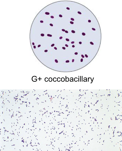 <p>Short gram positive rods/coccobacilli</p>