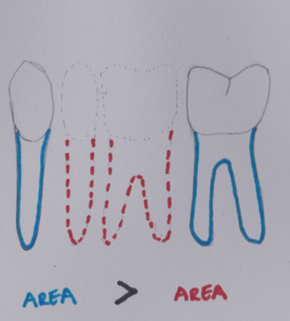 <p>The total periodontal membrane area of the abutment teeth must be equal or larger than that of the teeth to be replaced</p>
