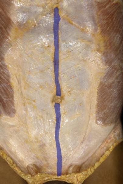 <p>skinny line, runs from xiphoid process to symphysis pubis</p>