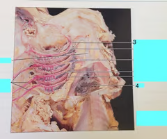 <p>efferent branchial arteries</p>