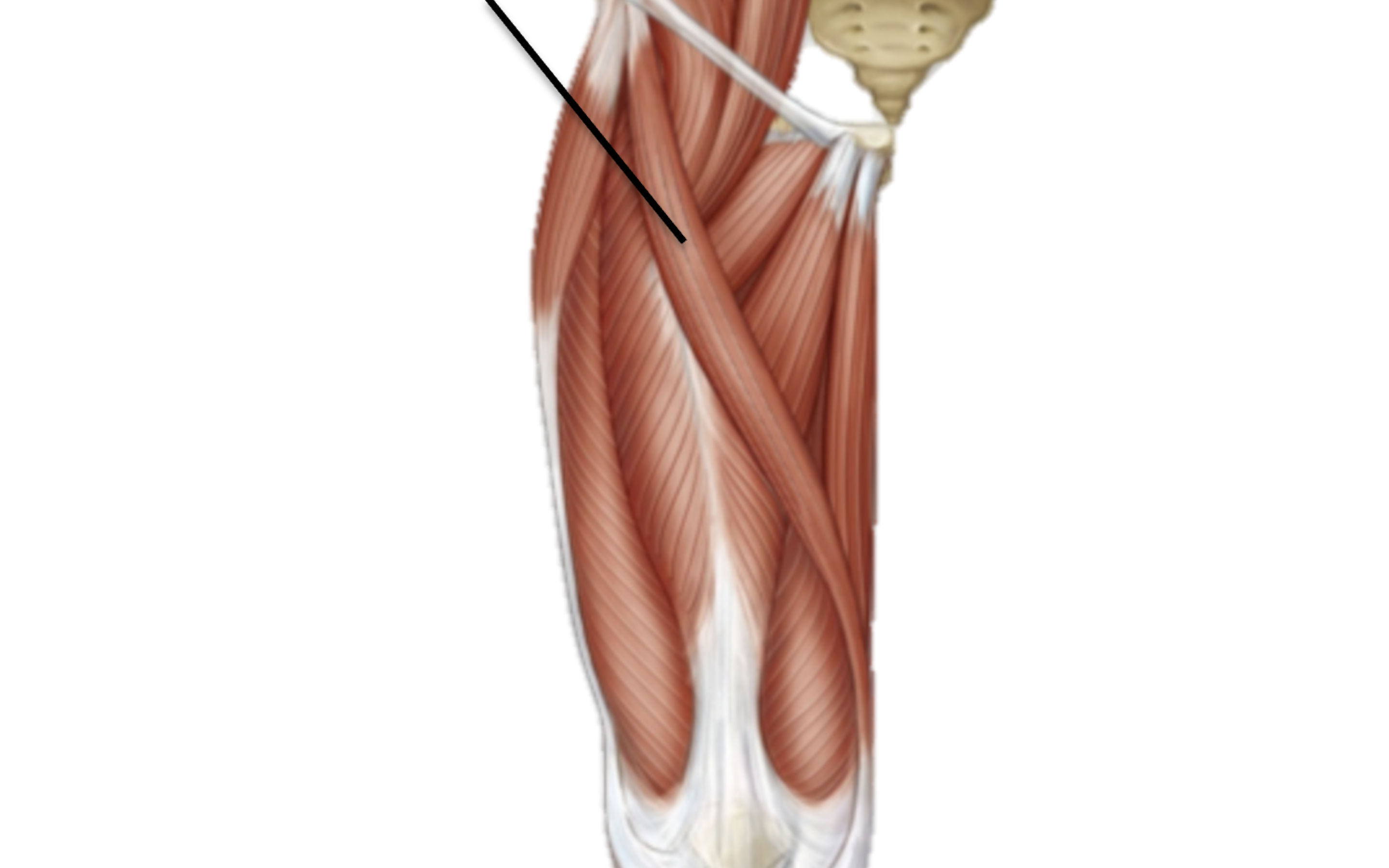 <p>What muscle is this?</p>