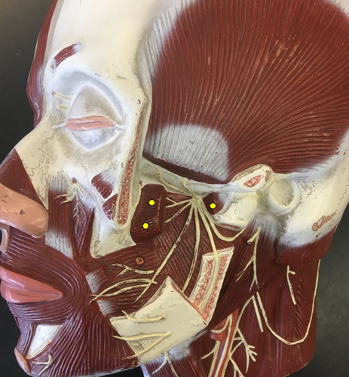 <p>Cut to show the muscle underneath</p>