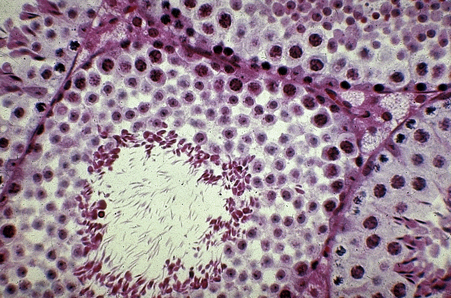 <p> Identify Sertoli cells, spermatogenic cells and the boundary layer. Also identify Leydig cells.</p>