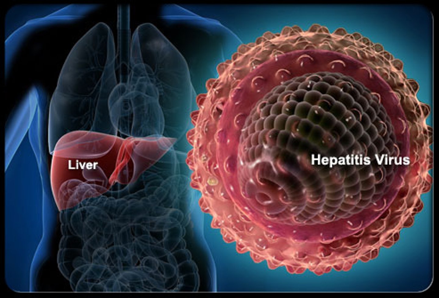 <p>a bloodborne virus that causes disease and can damage the liver</p>