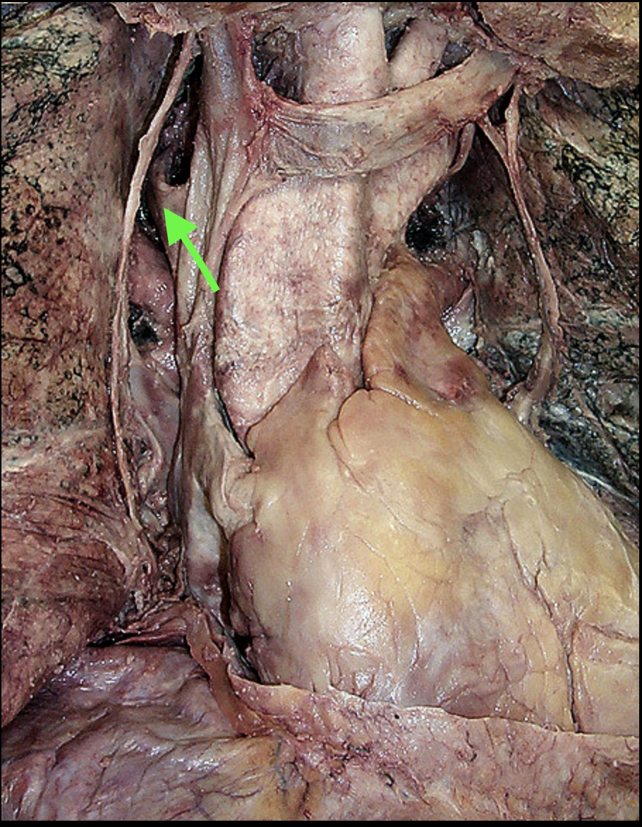 <p>Arrows points to the </p>