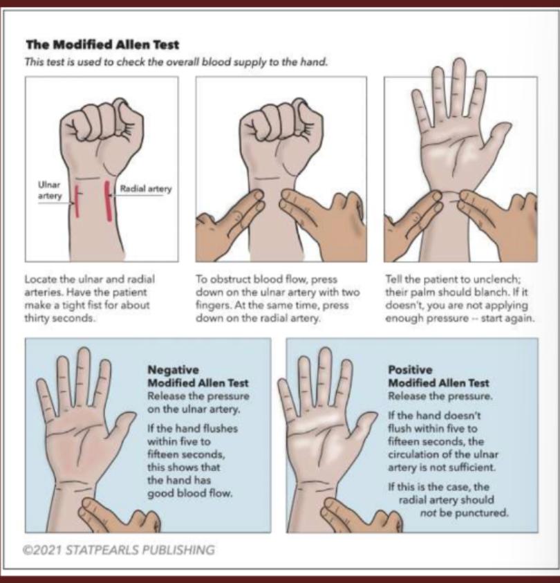 <p>Used to measure how well blood flows into a patient's hand&nbsp;</p>